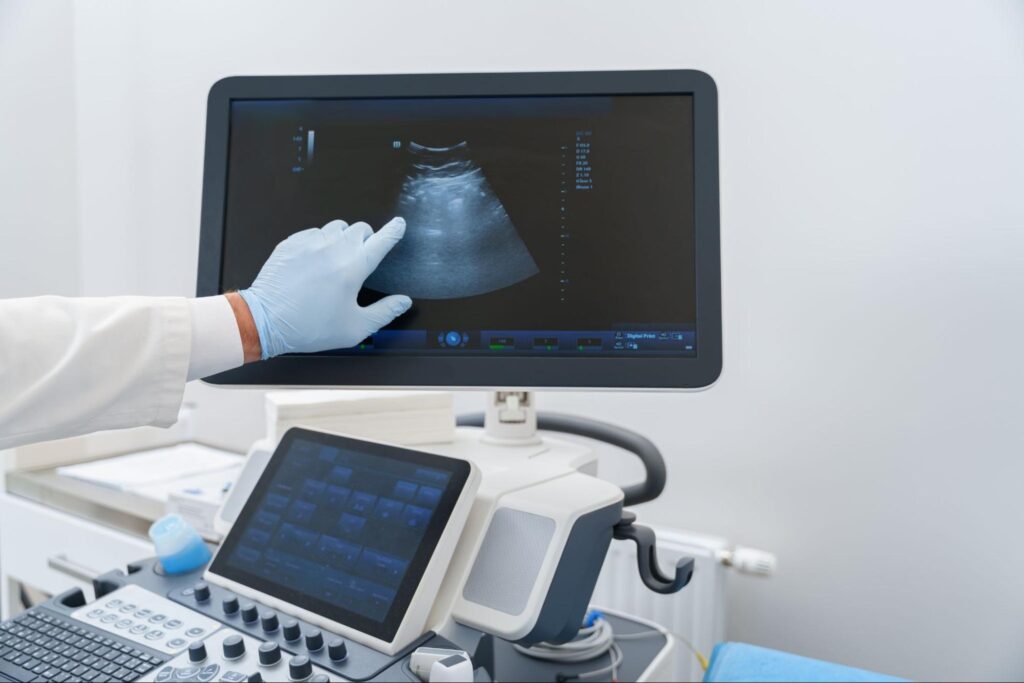 Advanced ultrasound imaging in a medical setting during a patient examination.