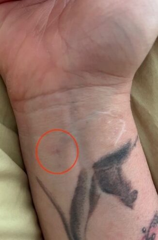 Close-up of a wrist with tattoo, skin texture, and a highlighted mark.