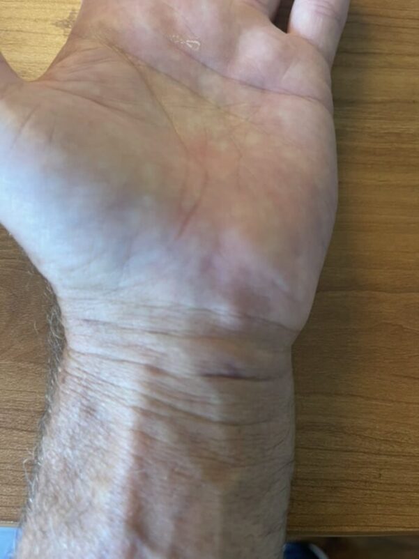 Joe s Left hand